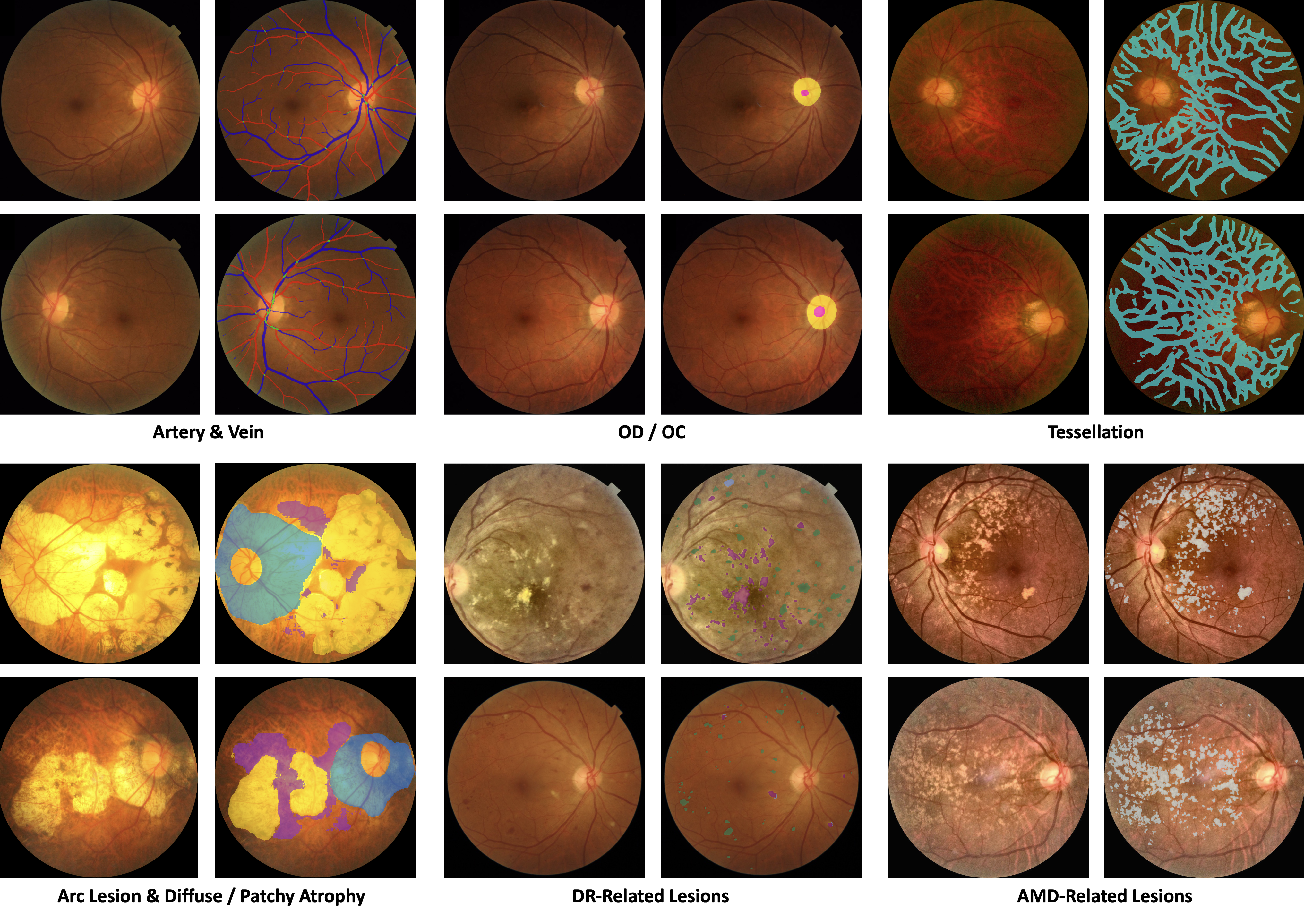 All segmentation results