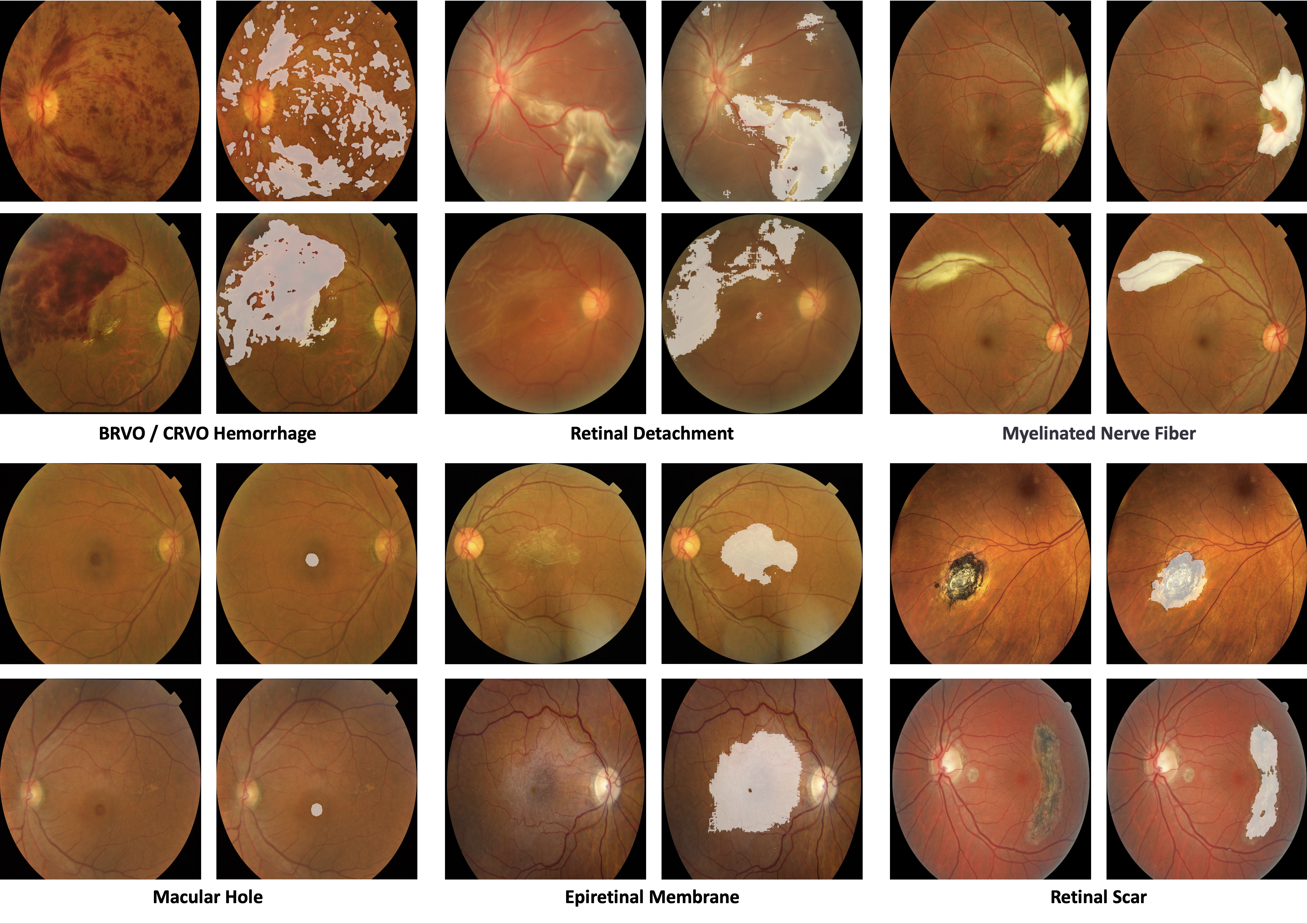 Other lesion results