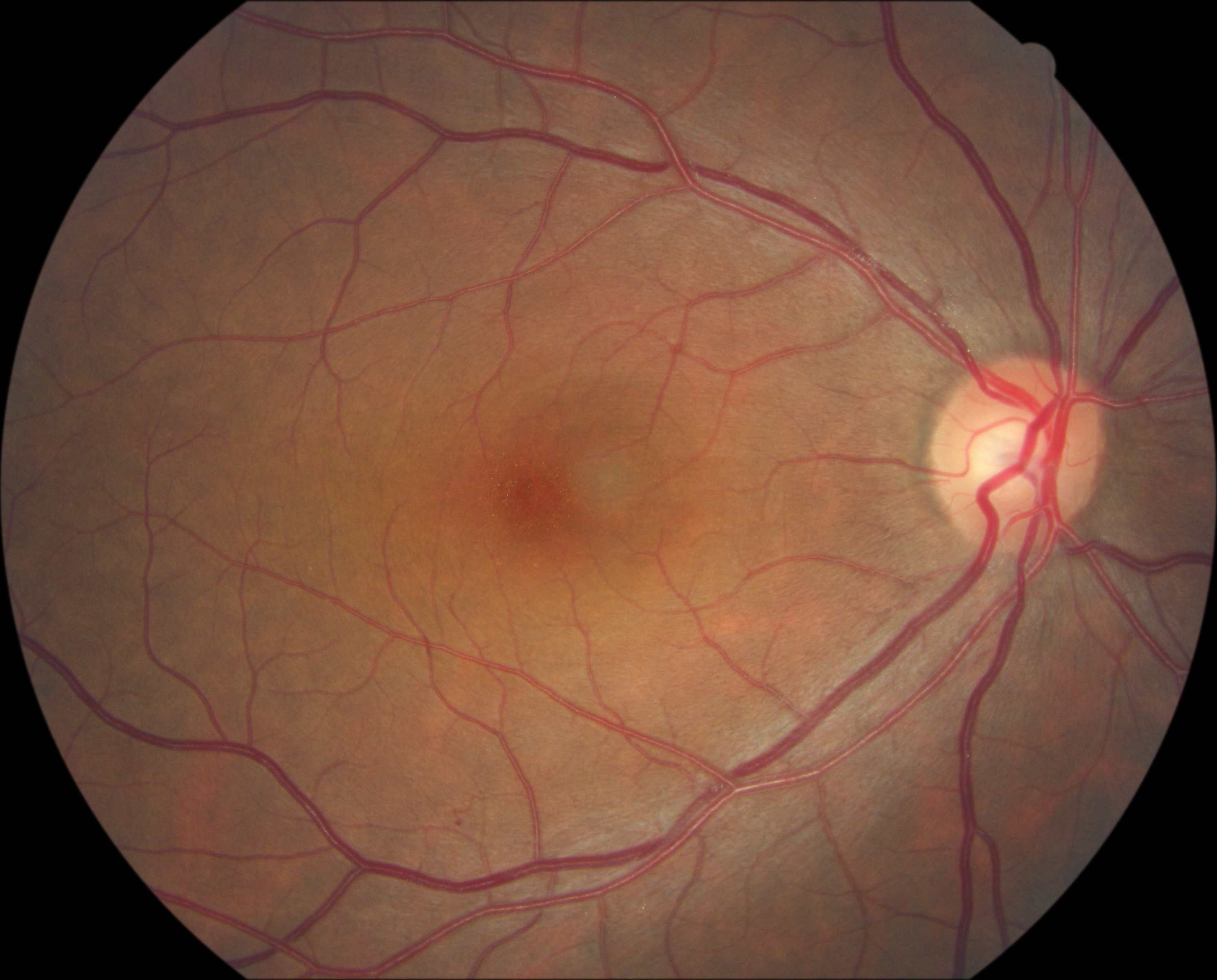 RetSAM visualization